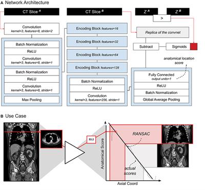 Development of a Prognostic AI-Monitor for Metastatic Urothelial Cancer Patients Receiving Immunotherapy